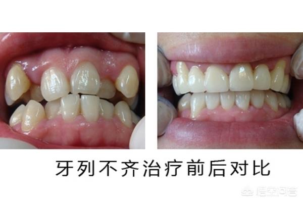 温州最新24小时牙医在线咨询方法分析(最方便真实的温州有没有24小时牙医方法)